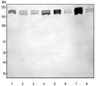 Western blot testing of 1) human A549, 2) human HEL, 3) human U-251, 4) human 293T, 5) rat testis, 6