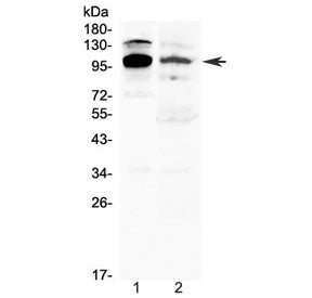NFAT2 Antibody / NFATC1 (isoforms A/B/C)