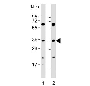 Western blot testing of human 1) K562 and 2) SW620 cell lysate with PIM2 antibody. Predicted molecul