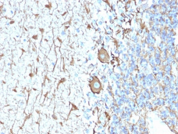 IHC staining of FFPE human cerebellum with recombinant Neurofilament antibody (clone NEFL.H/2324R).
