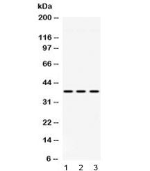 Western blot testing of 1) rat liver, 2) mouse heart and 3) human HeLa lysate with GNB1 antibody at