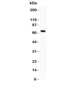 Estrogen Receptor Antibody (alpha)