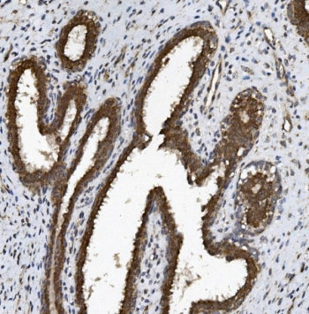 ABCG2 Antibody / BCRP