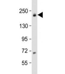 USP32 Antibody