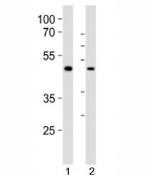 Western blot analysis of lysate from 1) human LNCaP and 2) mouse F9 cell line using Sox17 antibody a