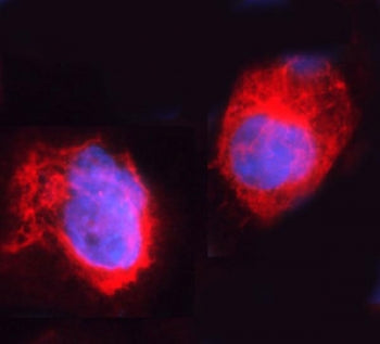 Immunofluorescent staining of FFPE human A431 cells with ARHGEF1 antibody (red) and DAPI nuclear sta