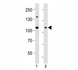 Western blot analysis of lysate from (1) HeLa cell line and (2) human skeletal muscle tissue using D