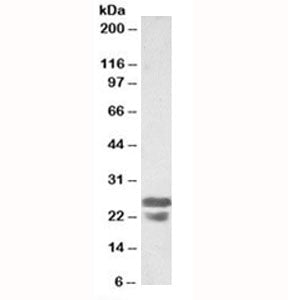 ASC Antibody / PYCARD