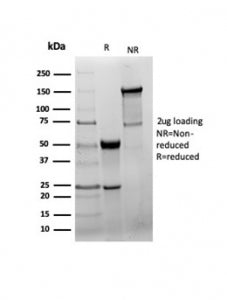 GAD65 Antibody / GAD2