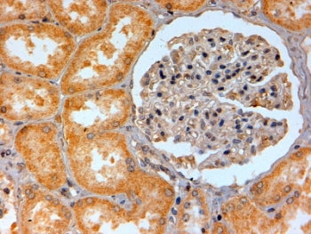 IHC testing of FFPE human kidney with ADORA2B antibody at 2ug/ml. HIER: steamed with pH6 citrate buffer, HRP-staining.
