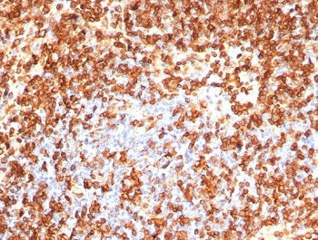CD74 Antibody