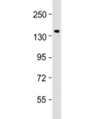 Collagen IV Antibody / COL4A3