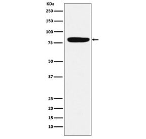 Factor XIIIa Antibody / F13A1