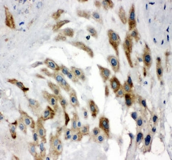 IHC staining of FFPE human placental tissue with Noggin antibody. HIER: boil tissue sections in pH8
