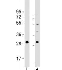 Western blot testing of human 1) RPMI 8226 and 2) SH-SY5Y cell lysate with PPAPDC1B antibody at 1:20