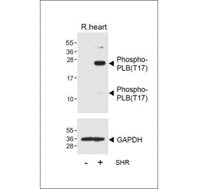Western blot testing of lysate from normal rat heart tissue and spontaneous hypertensive (SHR) rat h