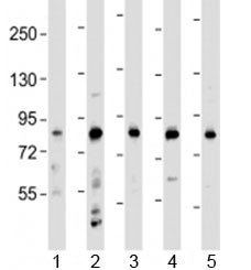 LRCH4 Antibody