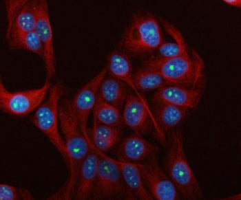Immunofluorescent staining of FFPE human HeLa cells with IMP4 antibody (green), Beta Tubulin mAb (re