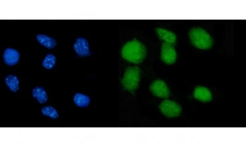 Immunofluorescent staining of FFPE mouse RM-1 cells with Nr0b2 antibody (green) and DAPI nuclear sta