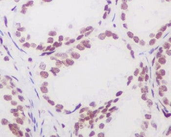 Androgen Receptor Antibody