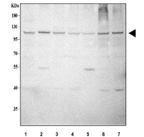 Western blot testing of 1) human Caco-2, 2) rat testis, 3) rat C6, 4) rat PC-12, 5) mouse testis, 6)