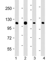 Western blot testing of human 1) K562, 2) Jurkat, 3) Raji and 4) SK-BR-3 cell lysate with CBL antibo