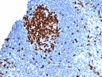 Ki-67 Antibody