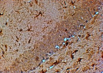 IHC testing of FFPE mouse hippocampus with TRPM7 antibody at 4ug/ml. HIER: steamed with pH6 or pH9 c