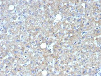 Glypican 3 Antibody / GPC3