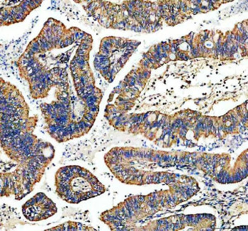 Immunohistochemical staining of TYRO3 using anti-TYRO3 antibody. TYRO3 was detected in a paraffin-em