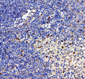 IHC staining of FFPE human spleen tissue with Interleukin-2 antibody, HRP-labeled secondary and DAB