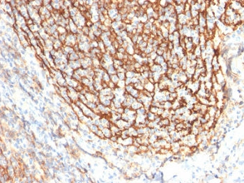 CD21 Antibody