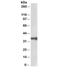 Western blot testing of human testis lysate with HSD17B3 antibody at 2ug/ml. Predicted molecular wei