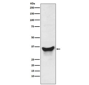 Nix Antibody / BNIP3L
