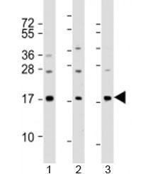 Western blot testing of human 1) A549, 2) HeLa and 3) spleen lysate with PLA2 antibody at 1:2000. Pr