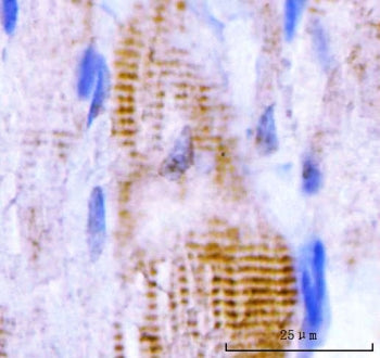 IHC staining of FFPE rat skeletal muscle tissue with M Cadherin antibody. HIER: boil tissue sections