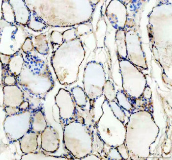 Western blot testing of 1) rat brain and 2) mouse brain lysate with TSH Receptor antibody. Predicted