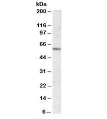 Western blot testing of human liver lysate with CES1 antibody at 0.03ug/ml. Predicted molecular weig