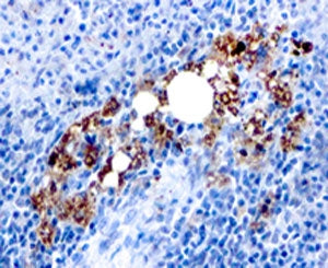 TRAcP Antibody / TRAP / ACP5