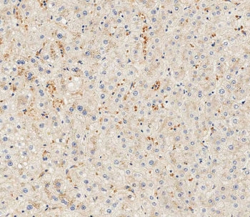 Hemopexin Antibody / HPX