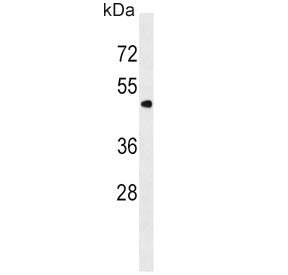 PNPLA3 Antibody