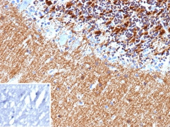 IHC staining of FFPE human brain tissue with Hexokinase 1 antibody (clone HK1/9514). Inset: PBS used
