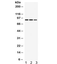MEFV Antibody / Mediterranean fever