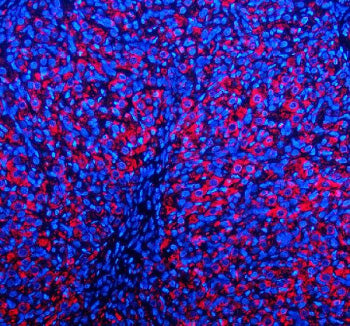 Immunofluorescent staining of EMC1 using anti-EMC1 antibody (red). EMC1 was detected in a paraffin-e