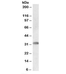Western blot testing of human bone marrow lysate with TREML1 antibody at 0.5ug/ml. Predicted molecul