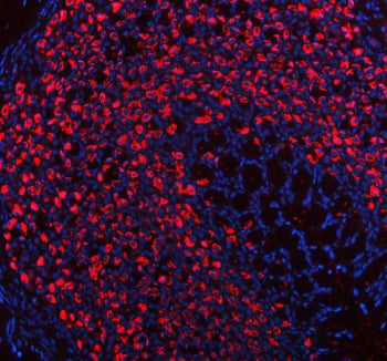 Immunofluorescent staining of ATP4B using anti-ATP4B antibody (red). ATP4B was detected in a paraffi