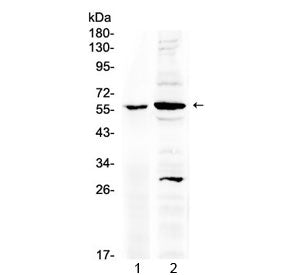 Western blot testing of 1) rat stomach and 2) mouse brain lysate with TNFR1 antibody at 0.5ug/ml. Pr