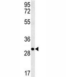 EpCAM Antibody