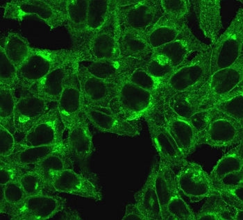 Beta-2 Microglobulin Antibody