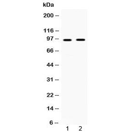 IFNGR1 Antibody / CD119